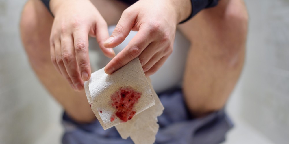 Targeted Relief for Bleeding Piles & Haemorrhoids